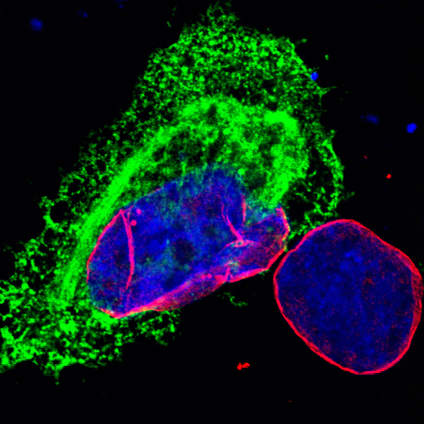 TRIMming Herpesvirus Infection