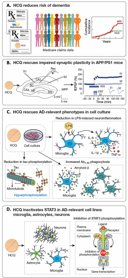 Hydroxychloroquine and Alzheimer’s disease