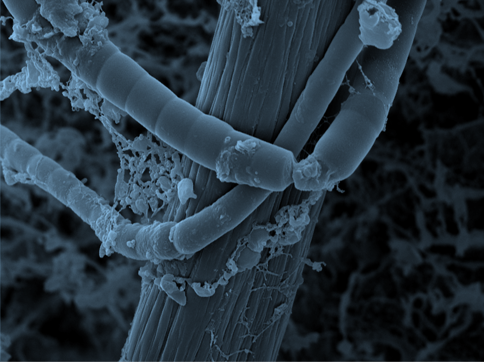 Understanding aquatic microplastic transport