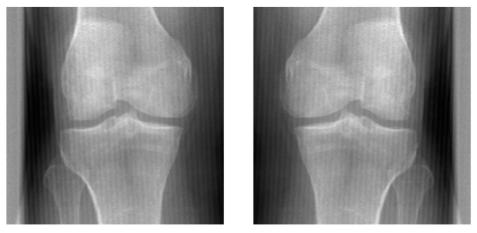 Improving the repeatability of deep learning models with Monte Carlo dropout