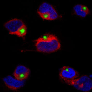 Inflammasome activation under high cholesterol load triggers a protective microglial phenotype while promoting neuronal pyroptosis 