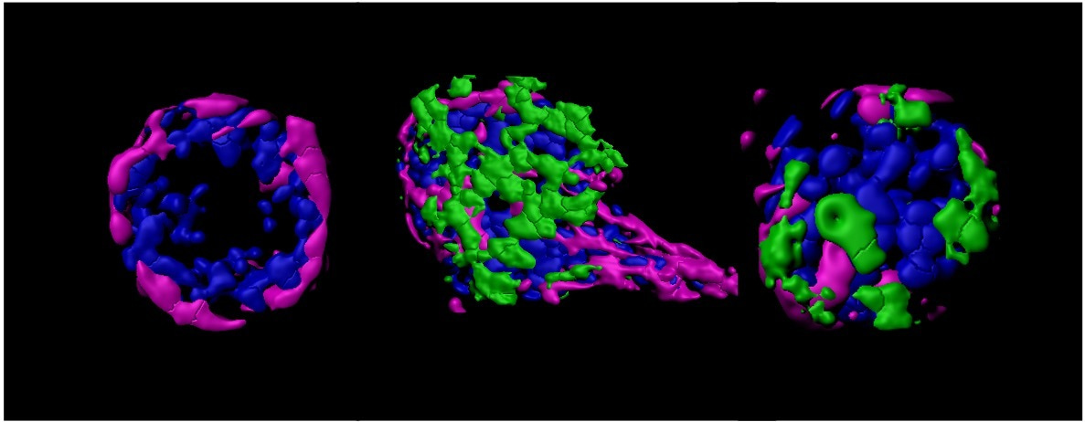TGFβ-mediated MMP13 secretion drives myoepithelial cell dependent breast cancer progression