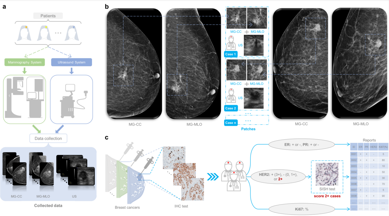 Predicting breast cancer types on and beyond molecular level in a multi-modal fashion