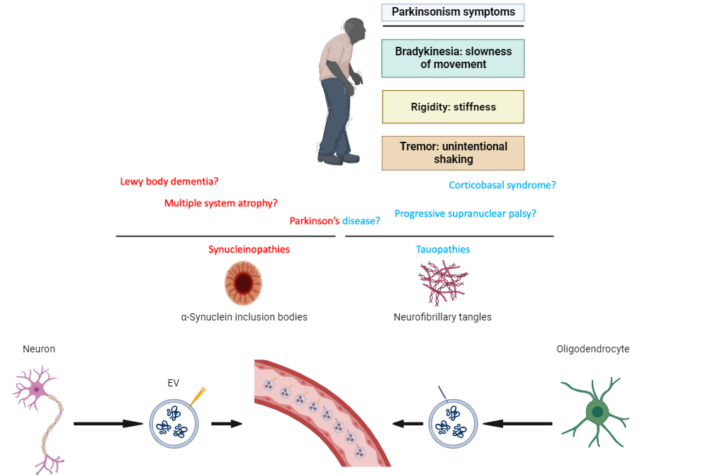Failure of Biomarkers in Extracellular Vesicles for Parkinson's disease and Related Disorders Diagnosis