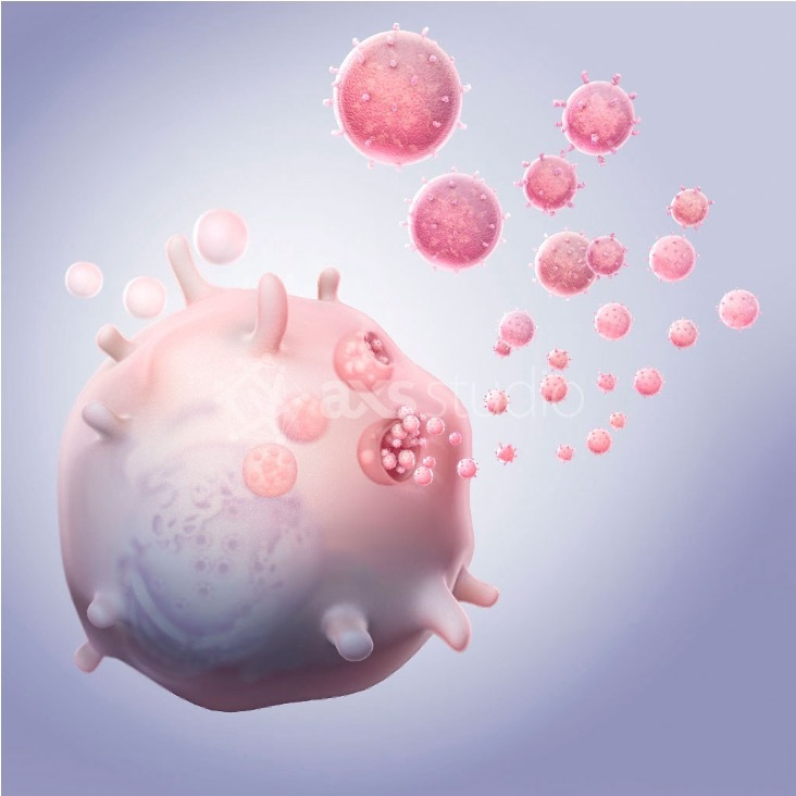 Diagnostic Dilemma: Tackling Challenges of CNS-Originating Extracellular Vesicle Biomarkers in Distinguishing Parkinson's Disease and Multiple System Atrophy