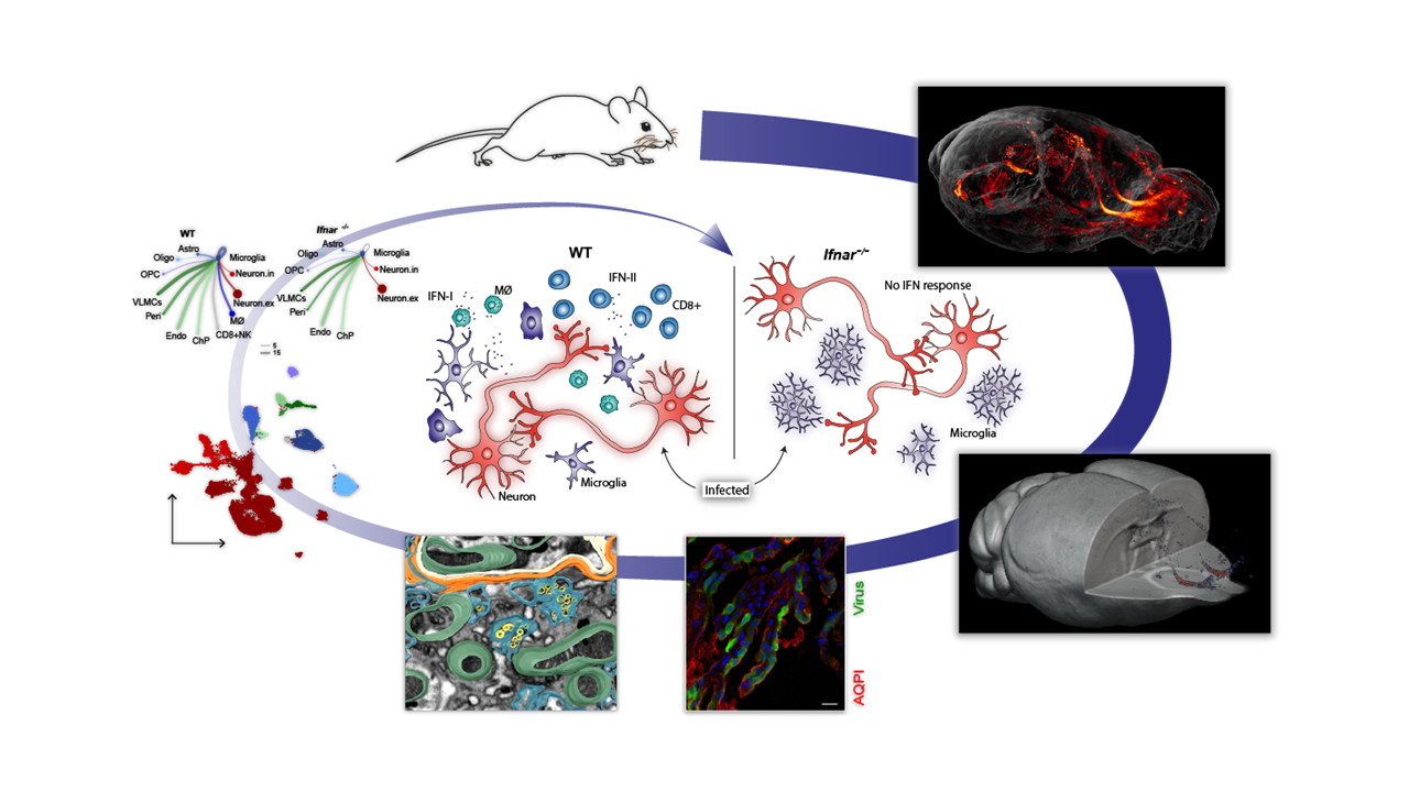 Virus-Infected Brain Through Different Lenses: From Whole-Brain Imaging to Molecular Interactions