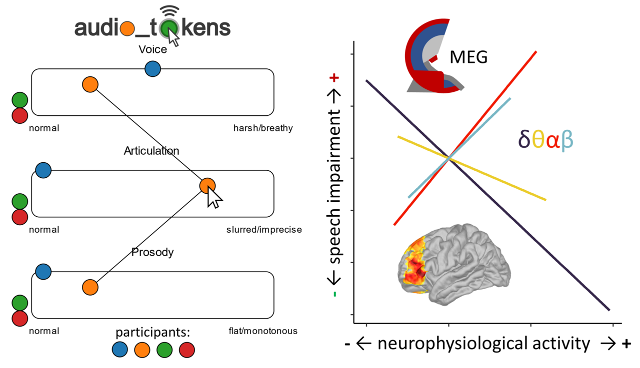 Aberrant neurophysiological signaling associated with speech impairments in Parkinson’s disease