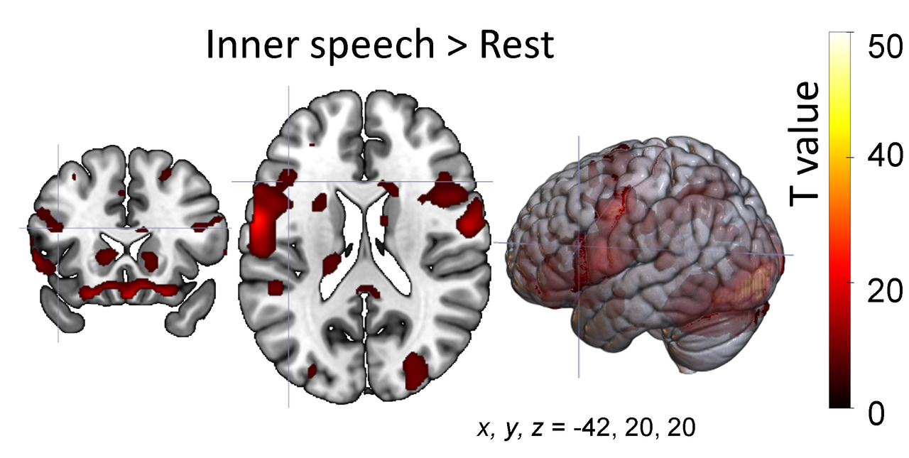 A novel bimodal dataset for inner speech recognition