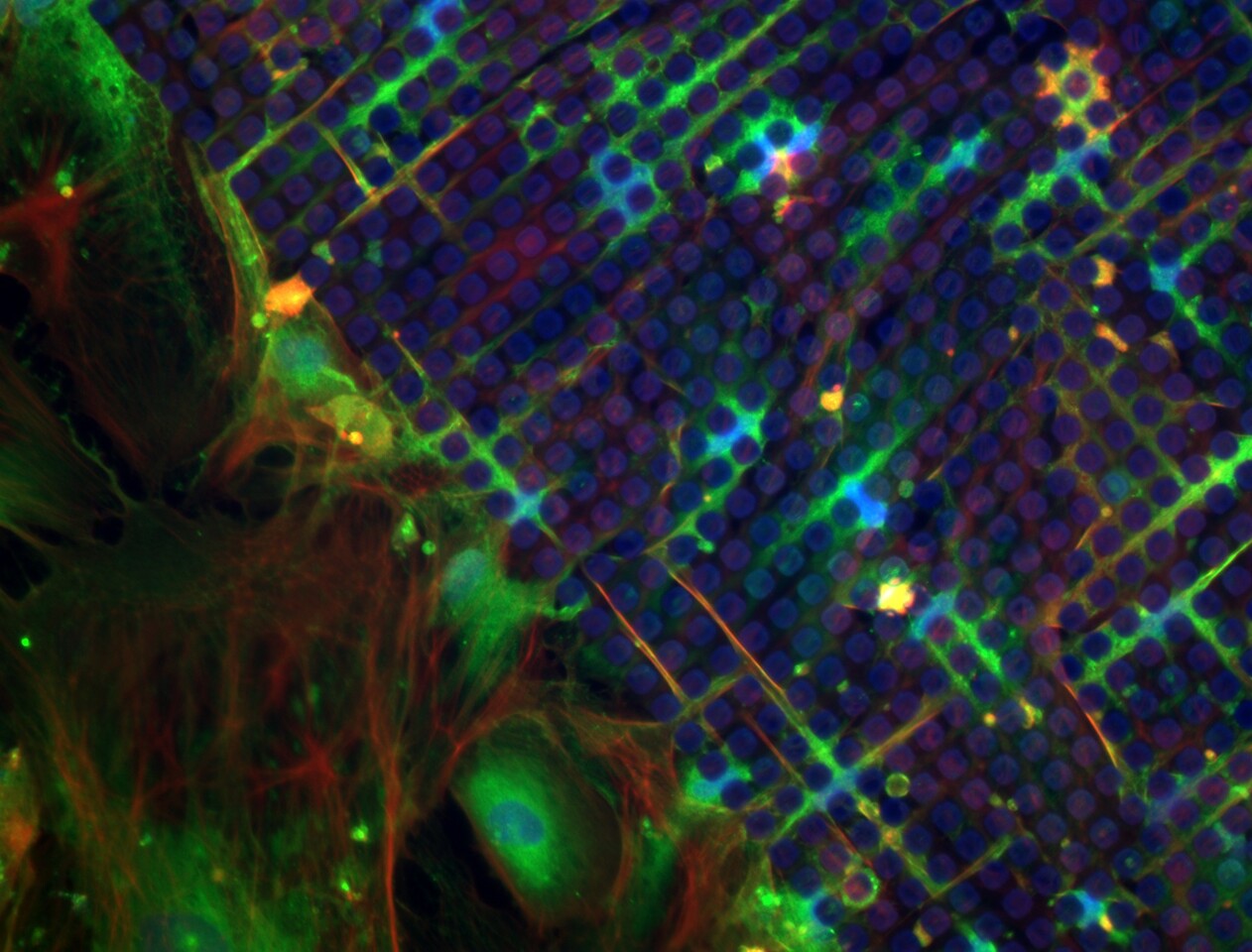 Chromatin Engineering as a Tool to Enhance Bone Regeneration 