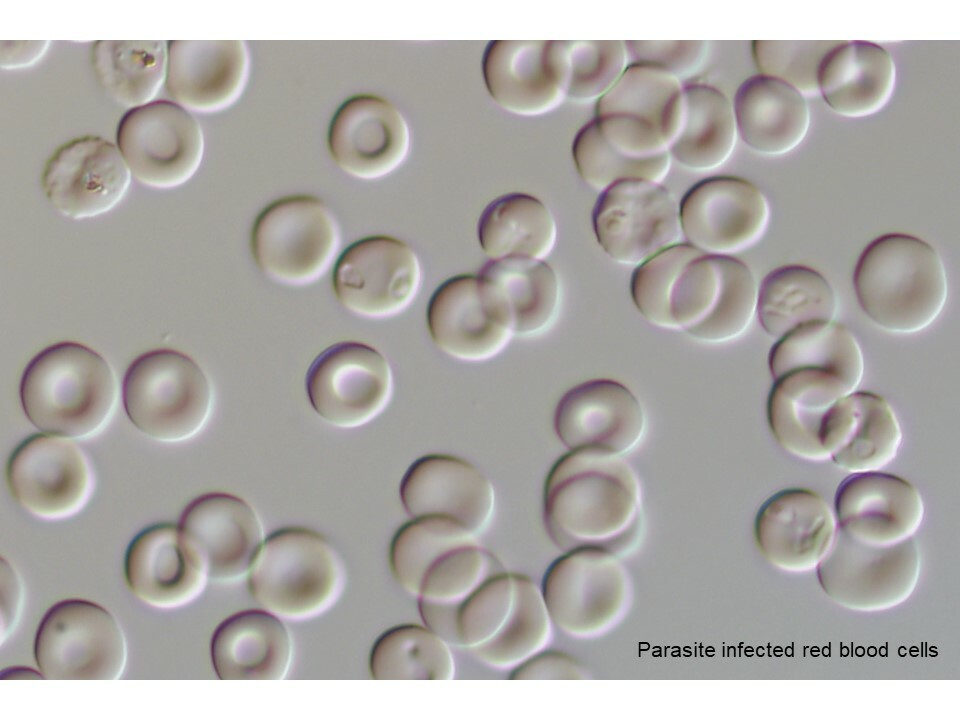 The secrets of a Malaria parasite enzyme PRMT5 revealed