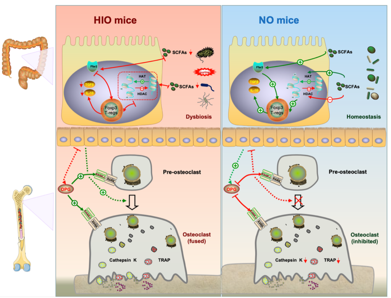 Obesity is a key trigger of bone loss