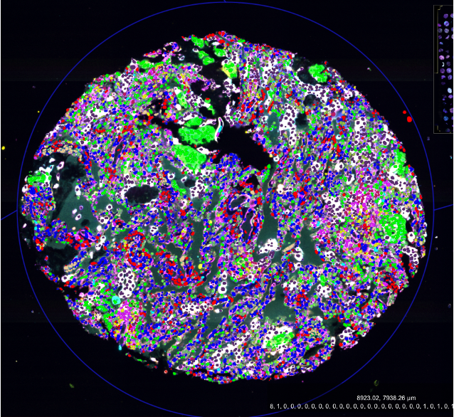 A deep-learning approach to predict spatial cellular architecture and prognosis in glioblastoma from histology images