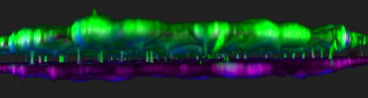 Instructing stem cells to help form a human kidney glomerulus-on-a-chip 