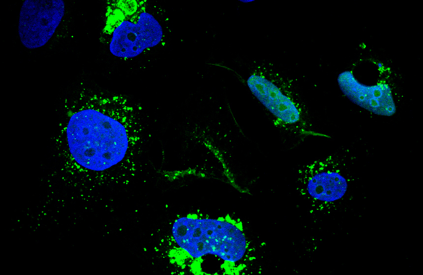 N7-methylguanosine methylation of tRNAs regulates survival to stress in cancer