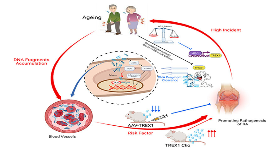 Age-related self-DNA accumulation may accelerate arthritis in rats and in human rheumatoid arthritis