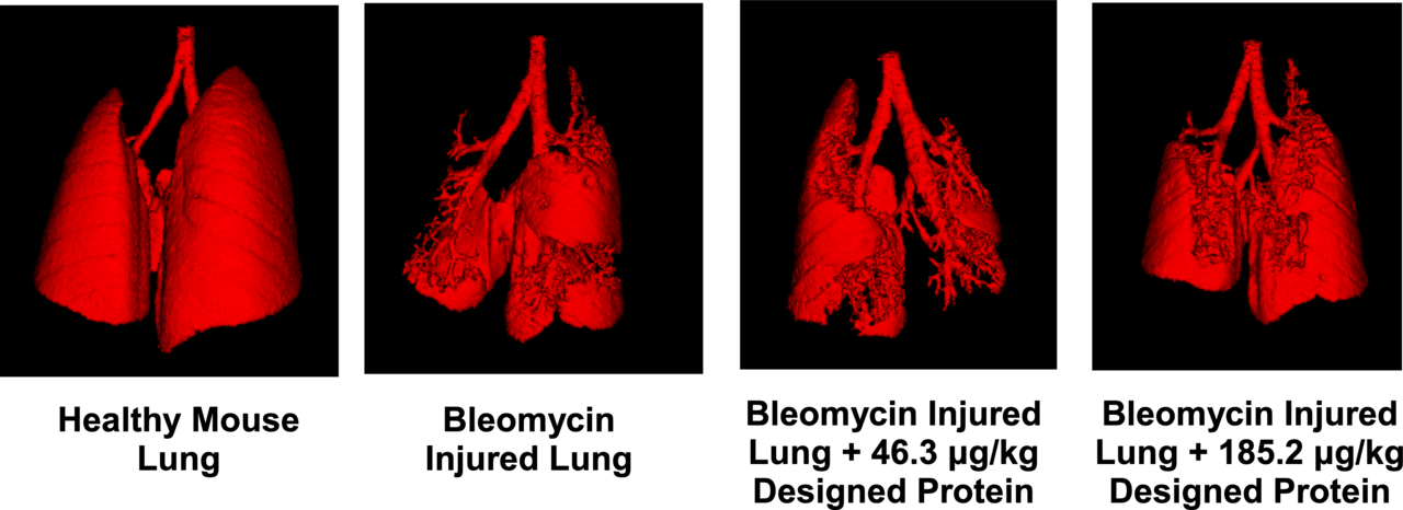 A Breath of Fresh Air: New Protein Inhibitors Offer Hope for Lung Fibrosis Patients