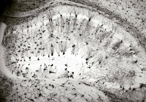 The formation and stabilisation of dendritic spines, a perspective on Cdk5-dependent dynamics activated by corticotropin-releasing factor. 