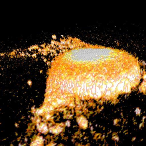 High-resolution method for the non-destructive imaging of tissue mineralization