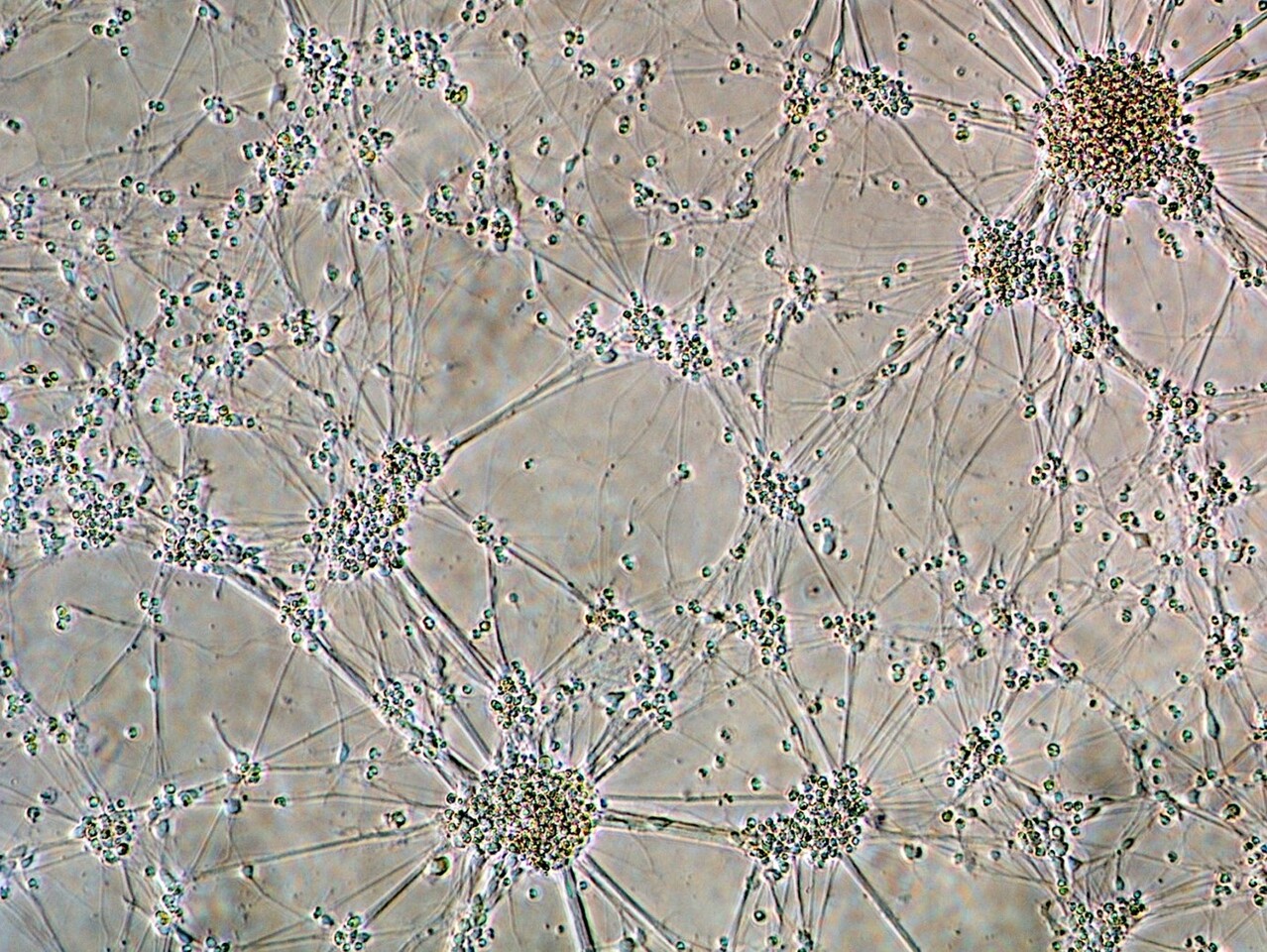 Why infection with herpes virus leads to encephalitis in a minority of children?