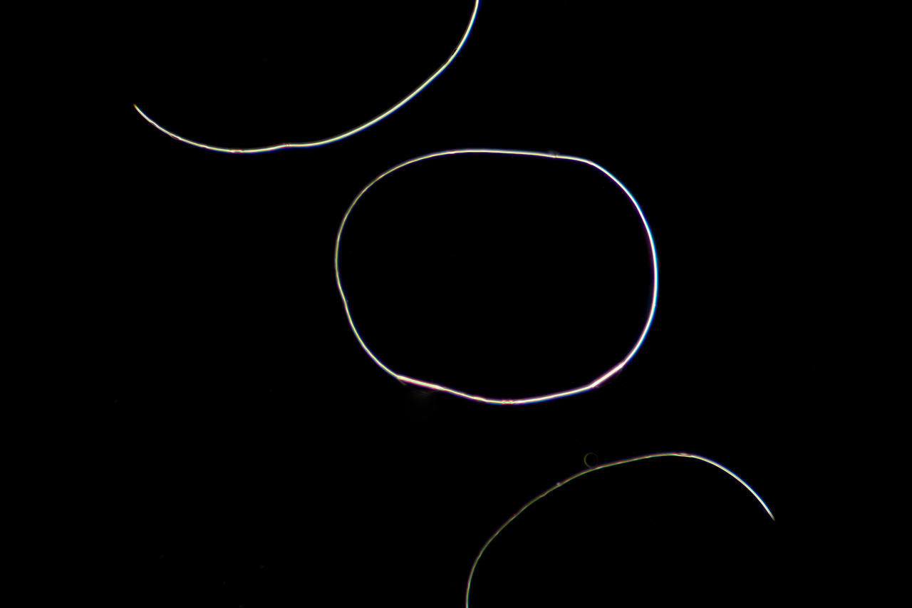 Journal Club: The physics behind those bacterial grenades on your agar plate