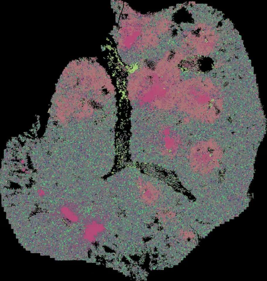 Alveolar dendritic cell–T cell immunity hubs defending against pulmonary infection