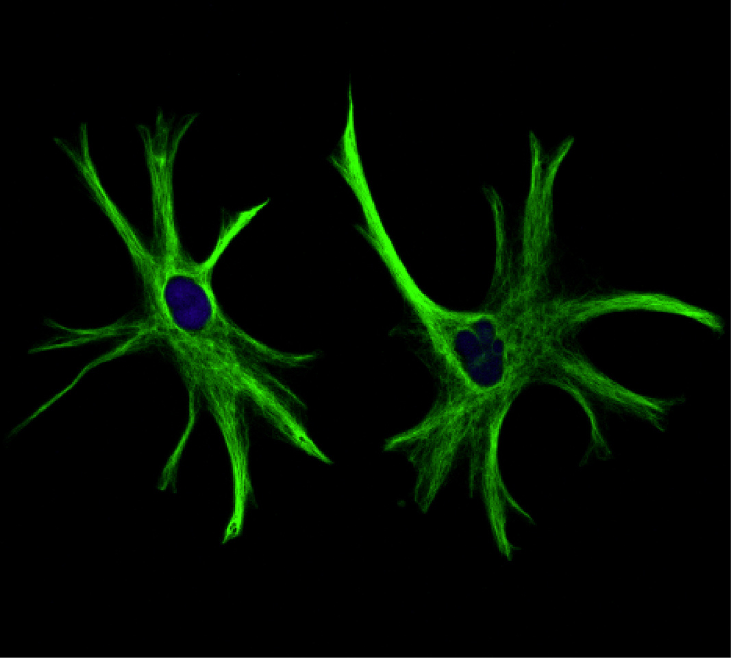AXL, receptor or signal transducer?