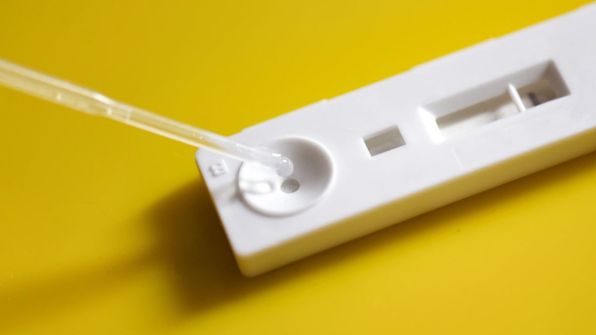 Call for papers: Point-of-care testing for low-resource settings Collection