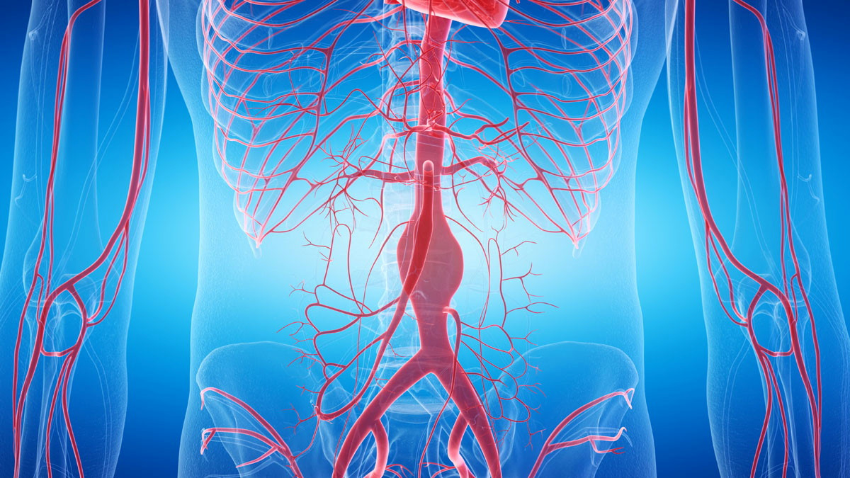 Call for papers: Aortic aneurysm and dissection management Collection 