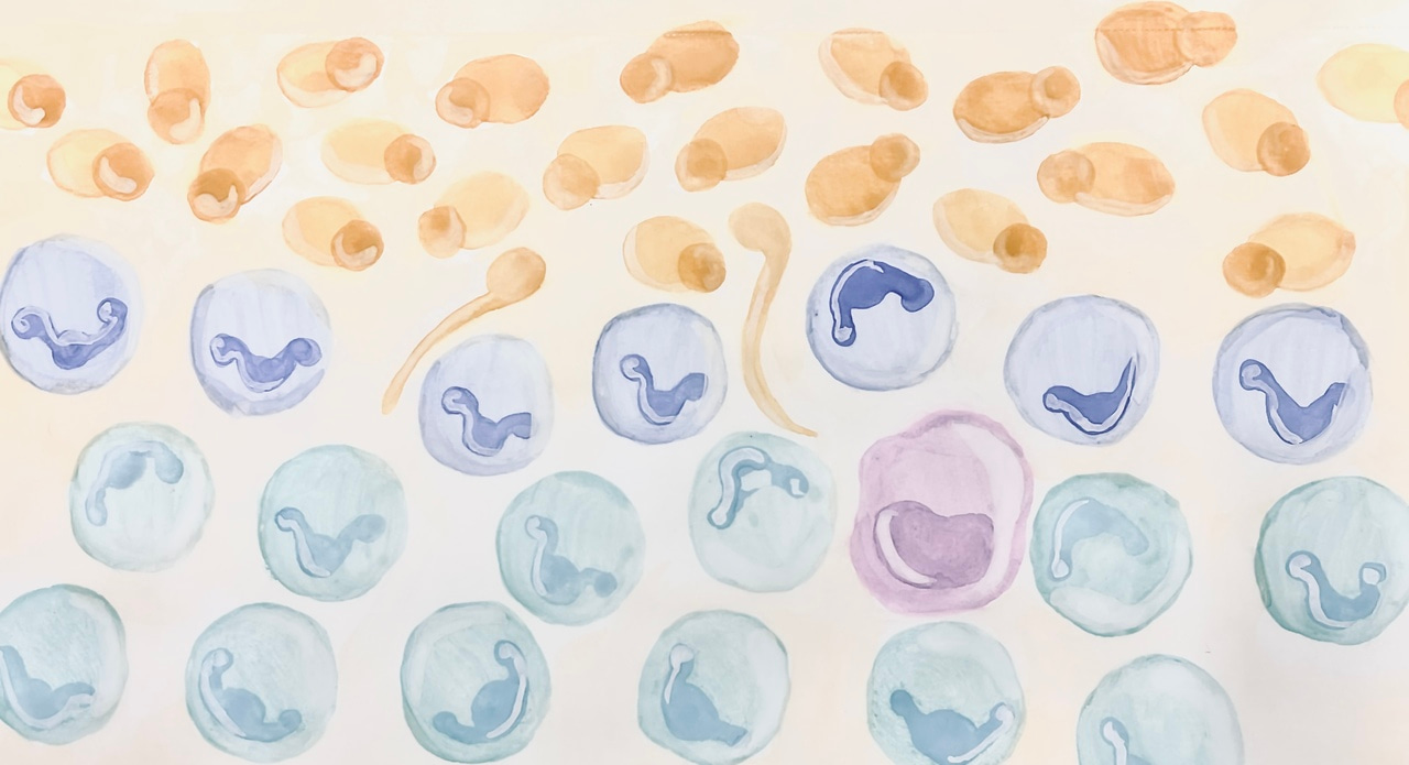 Lack of TYK2 Signaling Enhances Host Resistance to Candida albicans Skin Infection