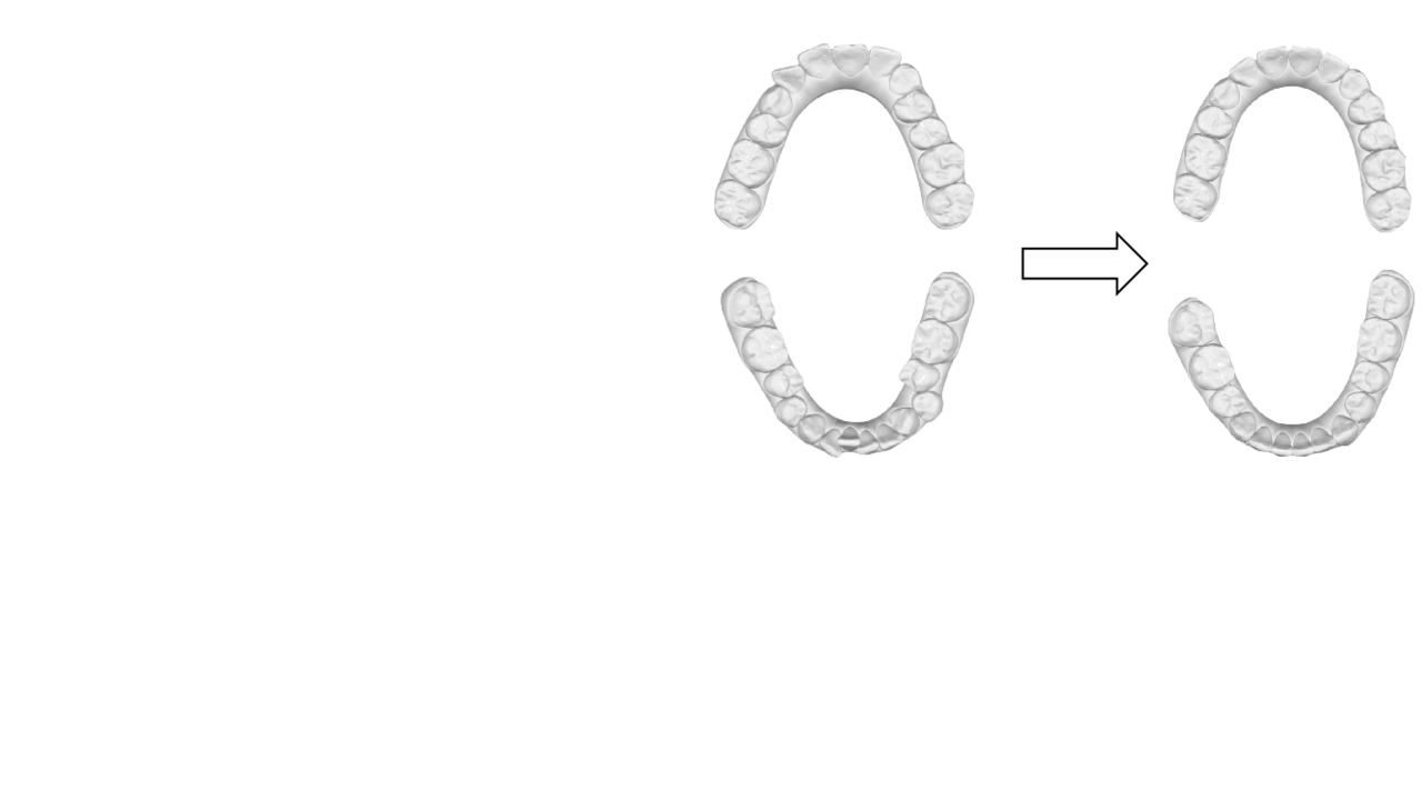 A 3D dental model dataset with pre/post-orthodontic treatment for automatic tooth alignment