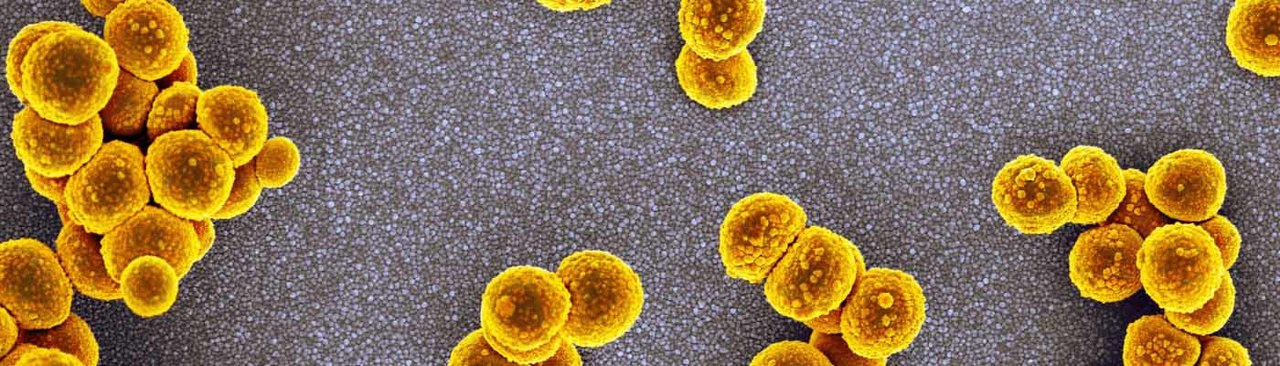 Free Collection: Antimicrobial resistance