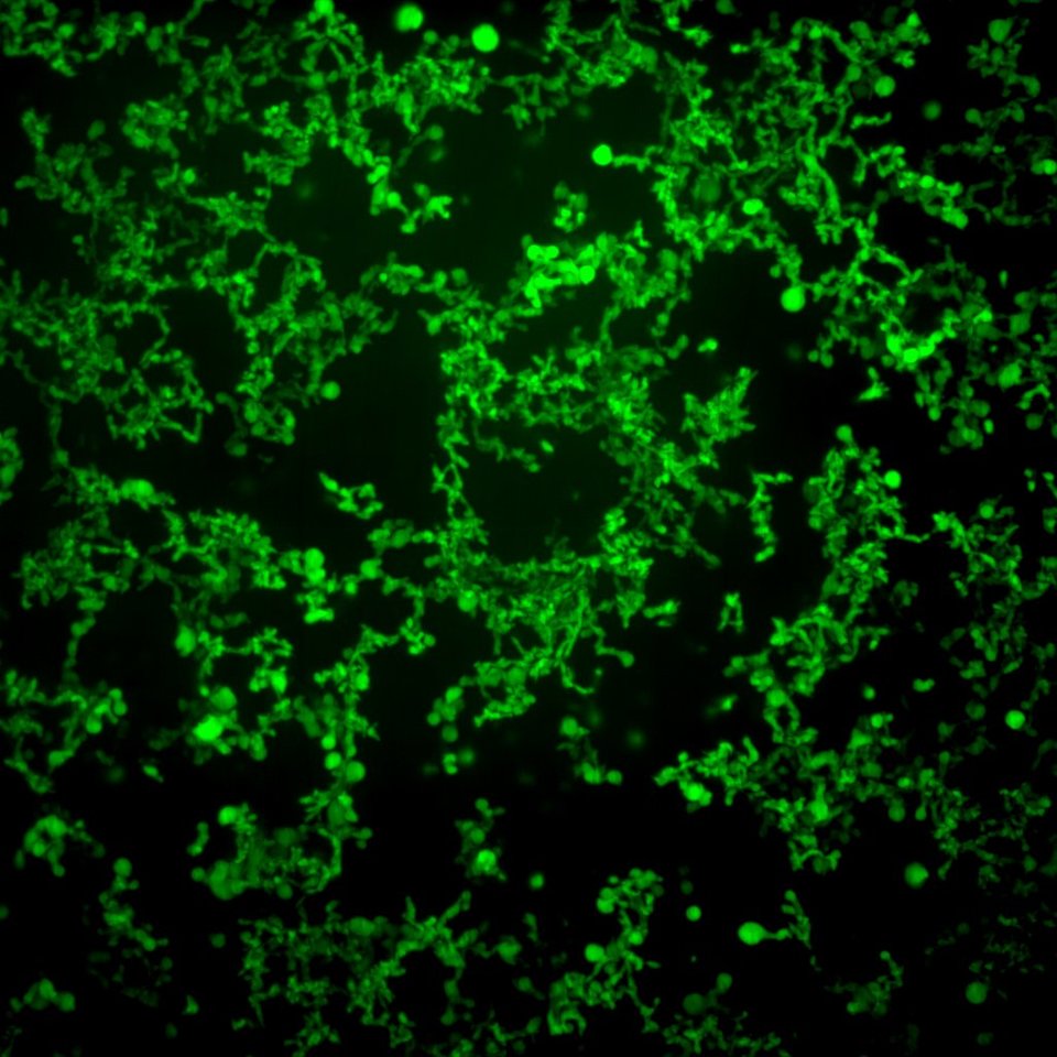 In the pursuit of FAME, one fatty acid at a time