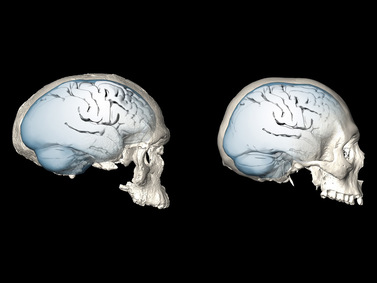 The evolution of modern human brain organization
