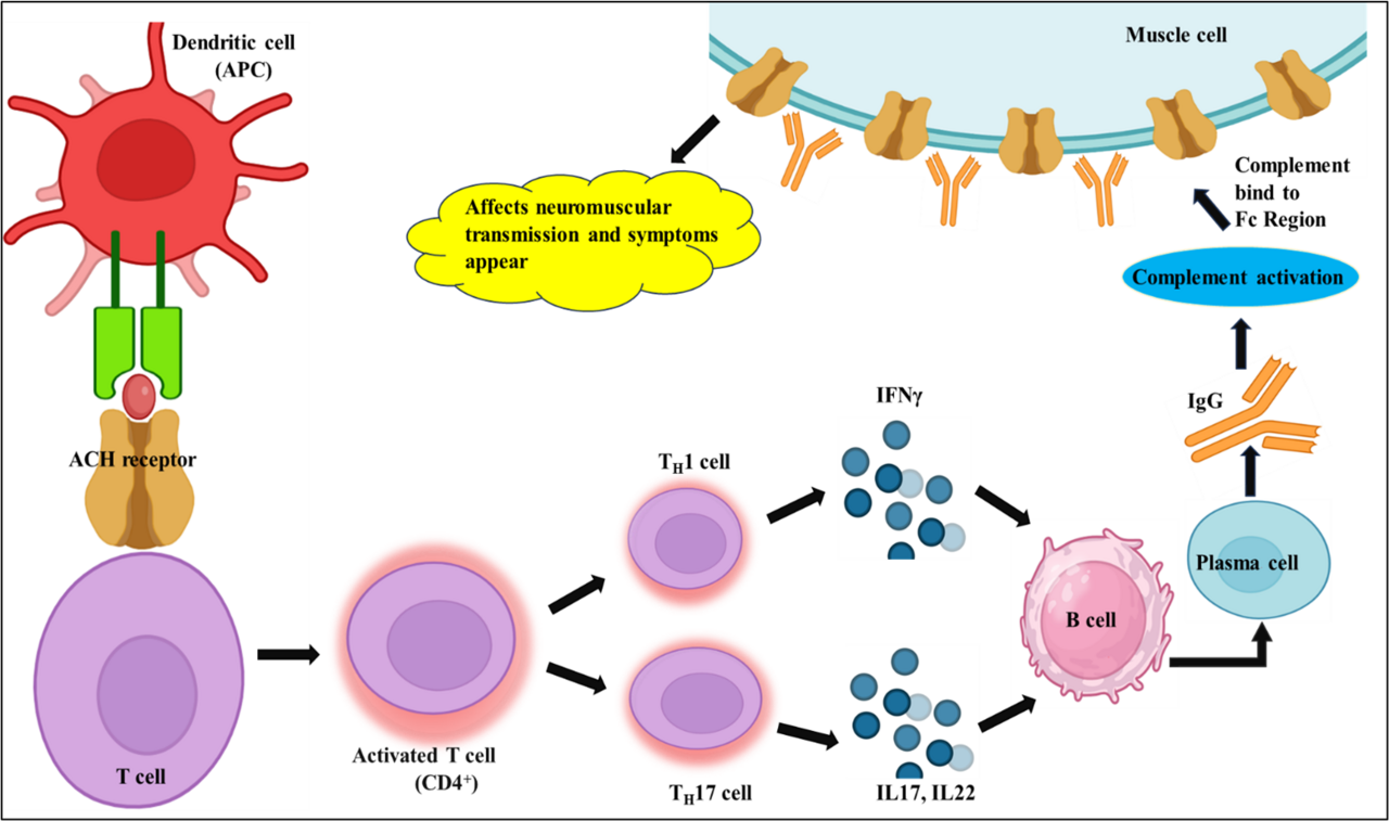 The Impact of Epstein-Barr Virus on Autoimmune Neuromuscular Disorders: A Comparative Study of Myasthenia Gravis and Guillain–Barre Syndrome