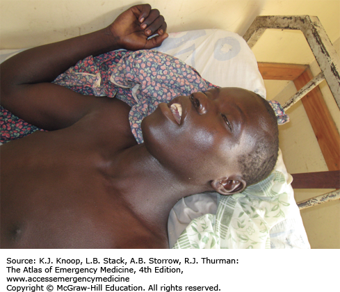 Image of the Week: Rabies