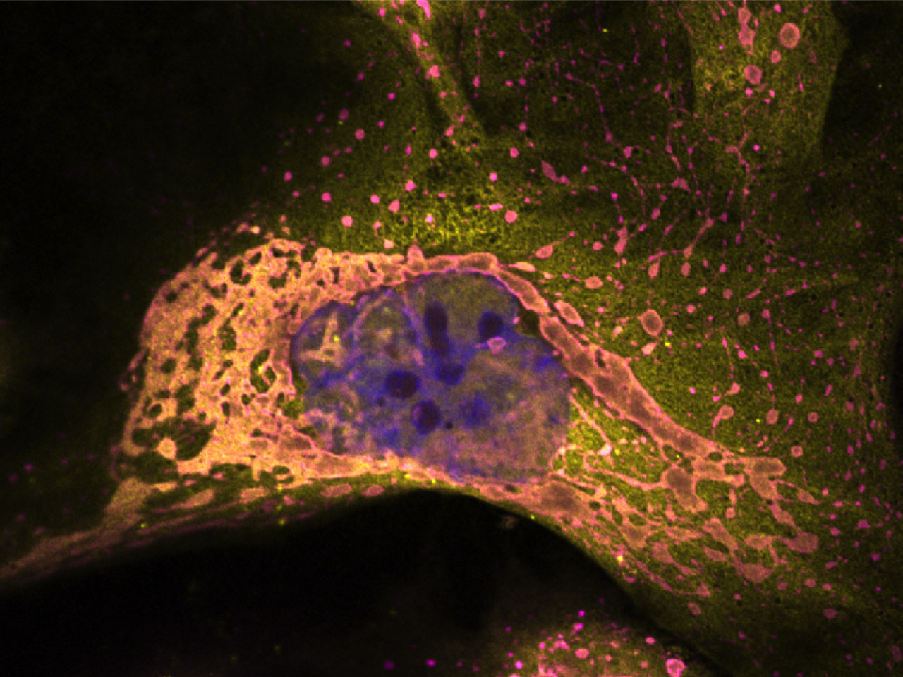 The magic TRiC: a eukaryotic chaperonin essential for virus capsid folding.