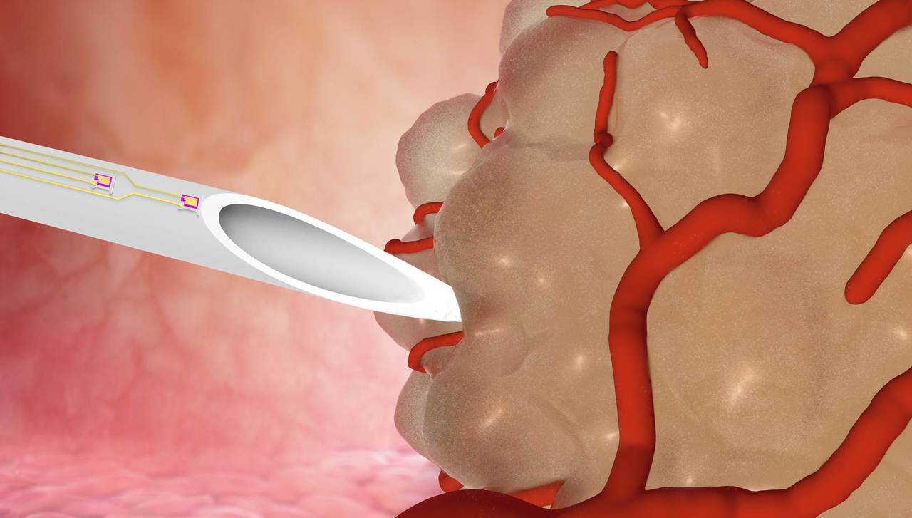 Assessing mechanical properties of tissue biopsies to increase diagnosis accuracy