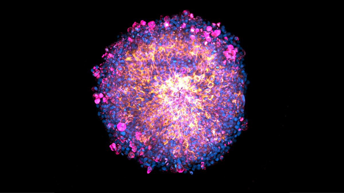 Designer homes for mini-placentas: A bioprinted solution