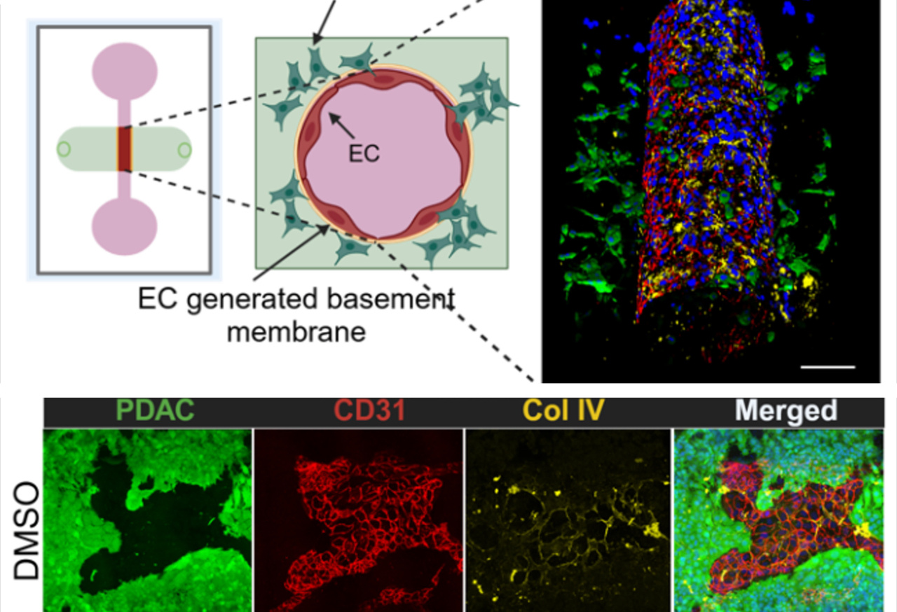 Cracking the Code of Pancreatic Cancer Spread: A New Role for ALK7