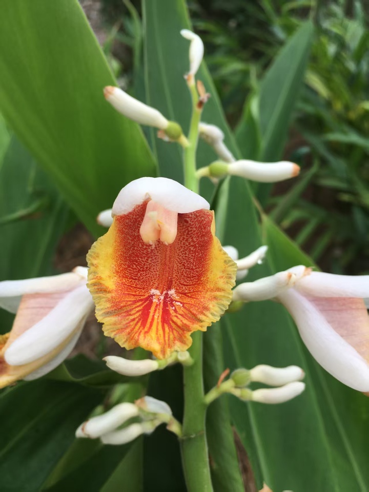 Ten-year pursuit of a dream: exploring the mystery of flexistyly