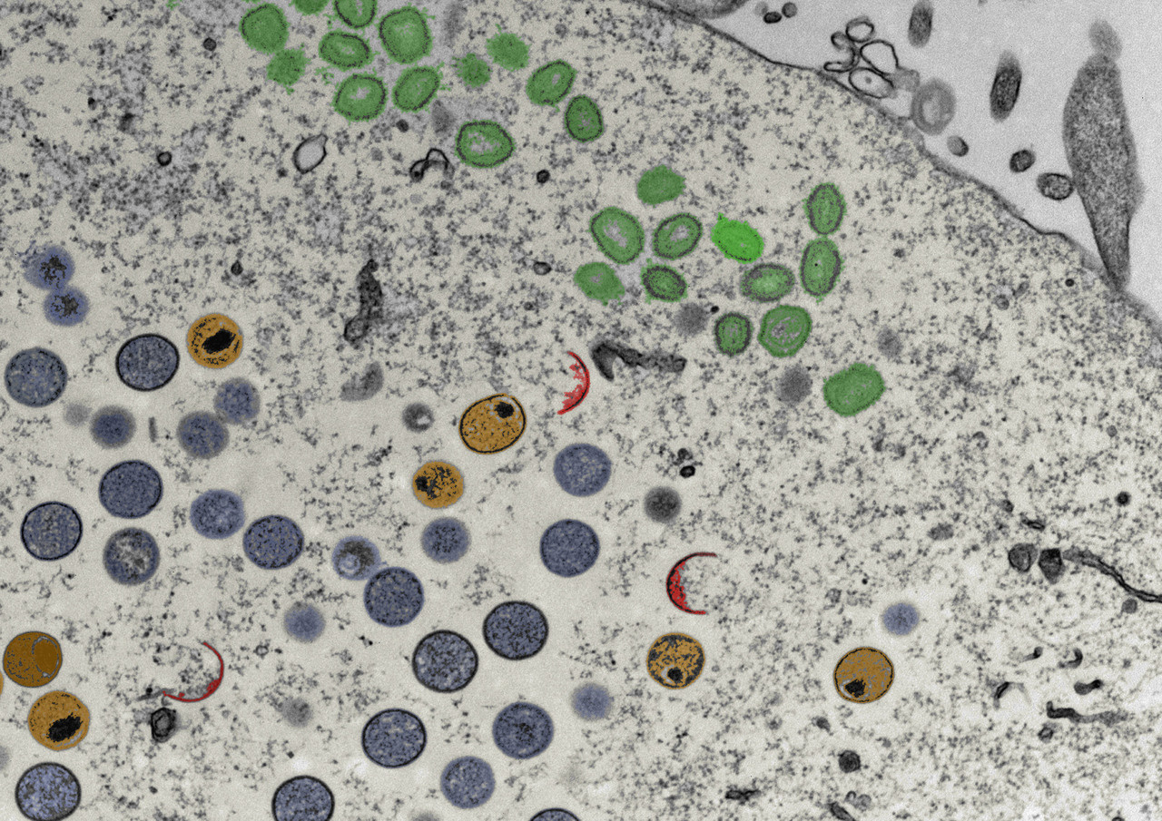 Vaccinia, mass spectrometry and electron microscopy: It takes three to tango.