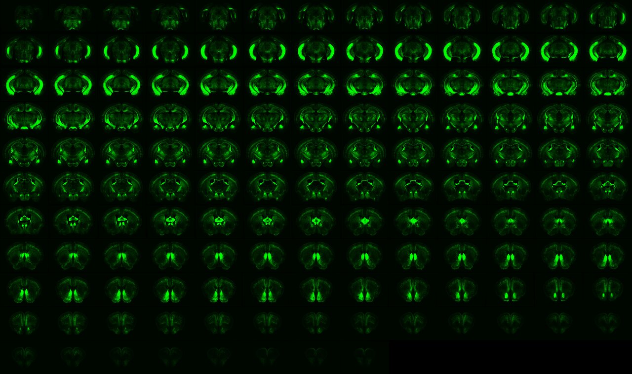 Discovery of a Unified Autism Circuit Signature via AI-Powered Whole-Brain Analysis