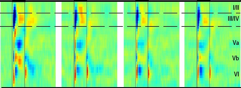 When rules change: how the brain learns through mistakes