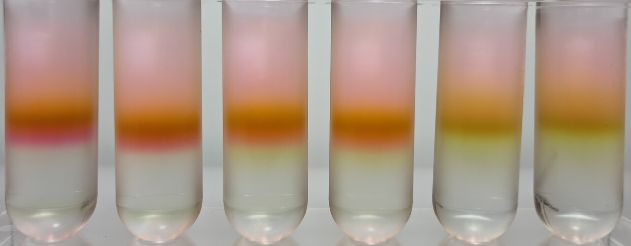 A glimpse into the role of auxiliary metabolic genes in cyanophages during infection