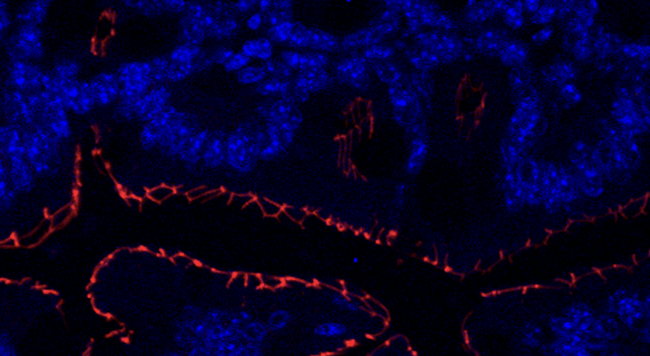 Behind the Paper: The Art of Losing - How Loss of Immunosuppressive Bacteria Shapes Immunotherapy Response 