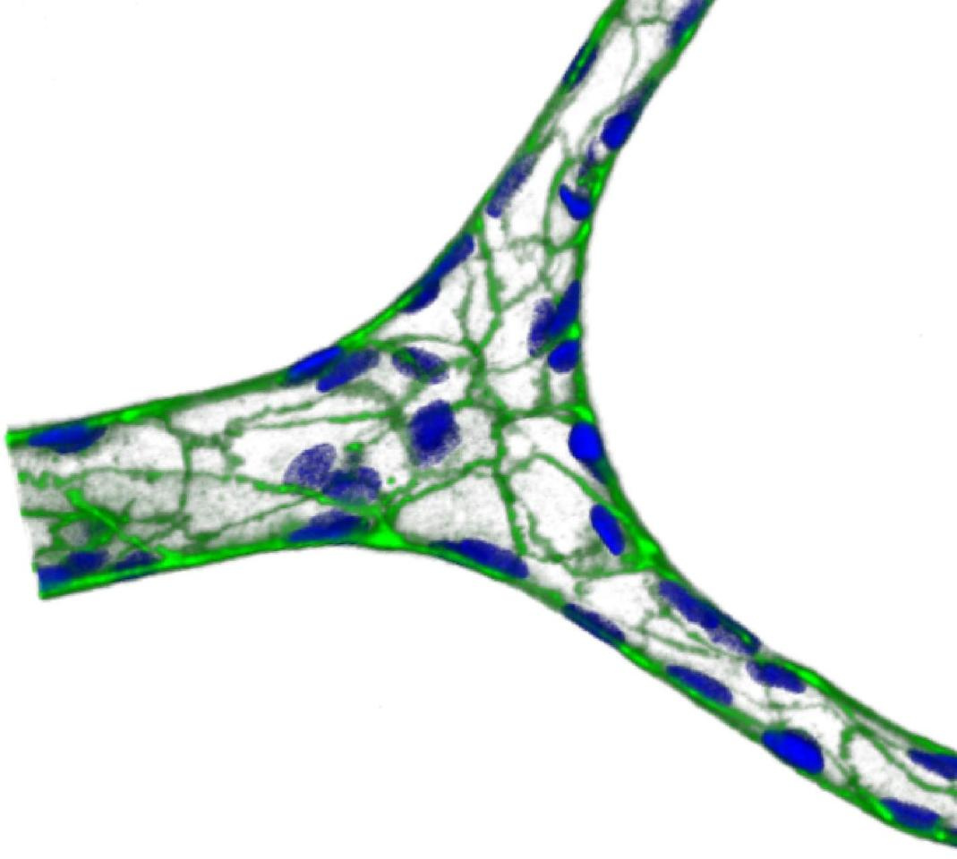 Building physiologically-relevant microvasculature-on-chips