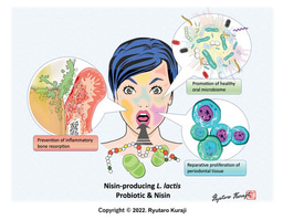The Many Healing Faces of Nisin  - Nisin and its Probiotic Prevent Inflammatory Bone Loss while Promoting Reparative Proliferation and a Healthy Microbiome    
