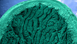 Springing human intestinal organoids forward