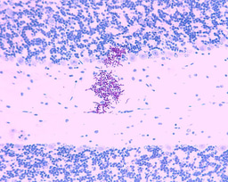 What makes Candida auris a super fungus?