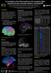 Efferent Pathways of the Amygdala in MDD